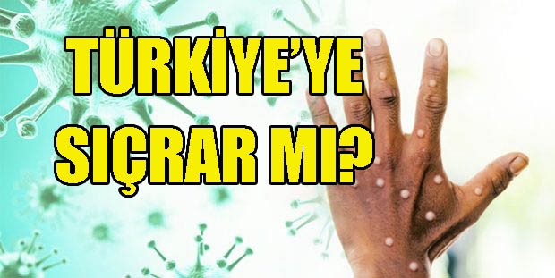 Maymun çiçeği virüsü Türkiye'ye sıçradı mı?