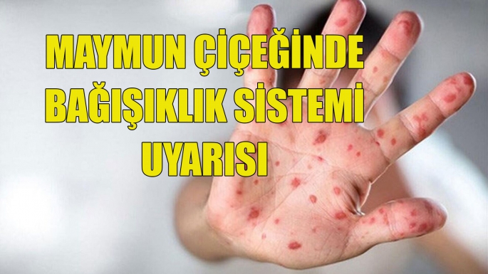 Maymun Çiçeğinde Bağışıklık Sistemi Uyarısı