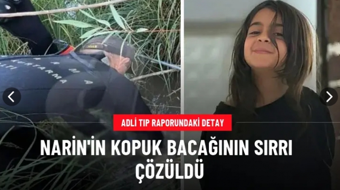 Narin'in kopuk bacağının sırrı çözüldü