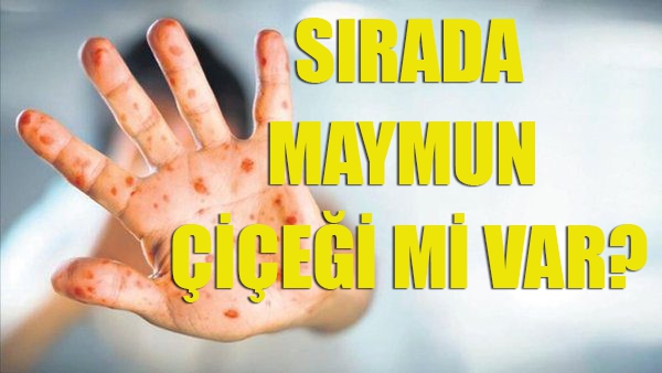 Sırada Maymun Çiçeği var mı?