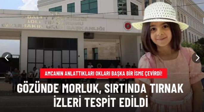 Soruşturmanın seyrini değiştirecek detaylar! 